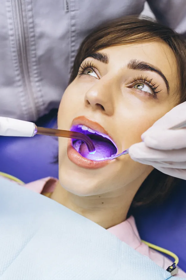 26213 teeth whitening lakewood co before after