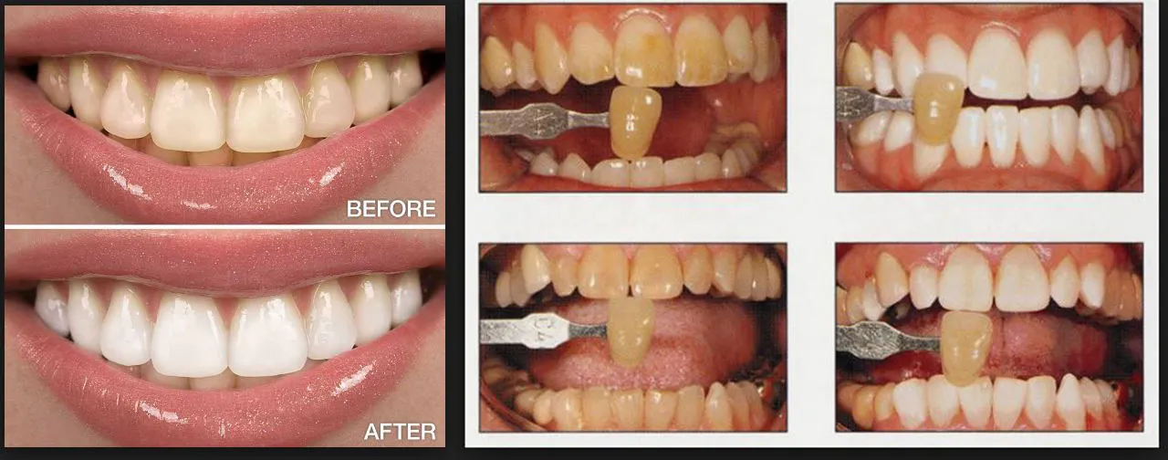 26222 social professional impact