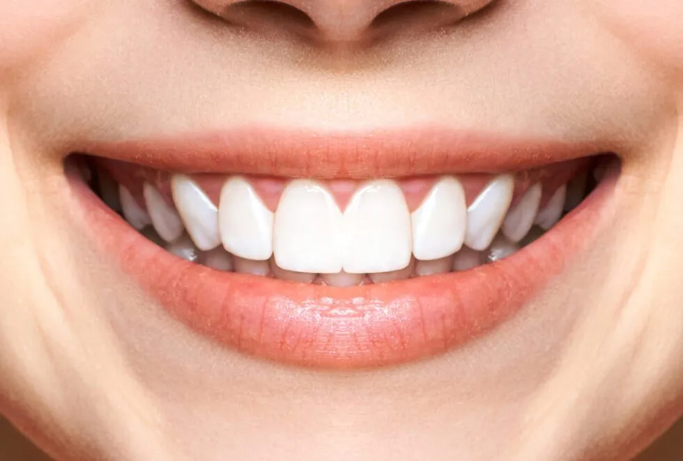 26229 custom teeth whitening trays