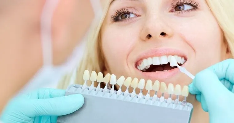 26238 teeth whitening before after