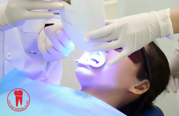 26244 teeth whitening vietnam overview