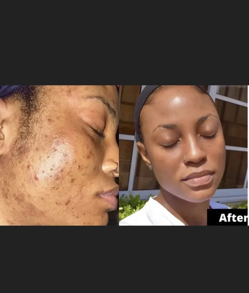 26246 turmeric face mask inflammation