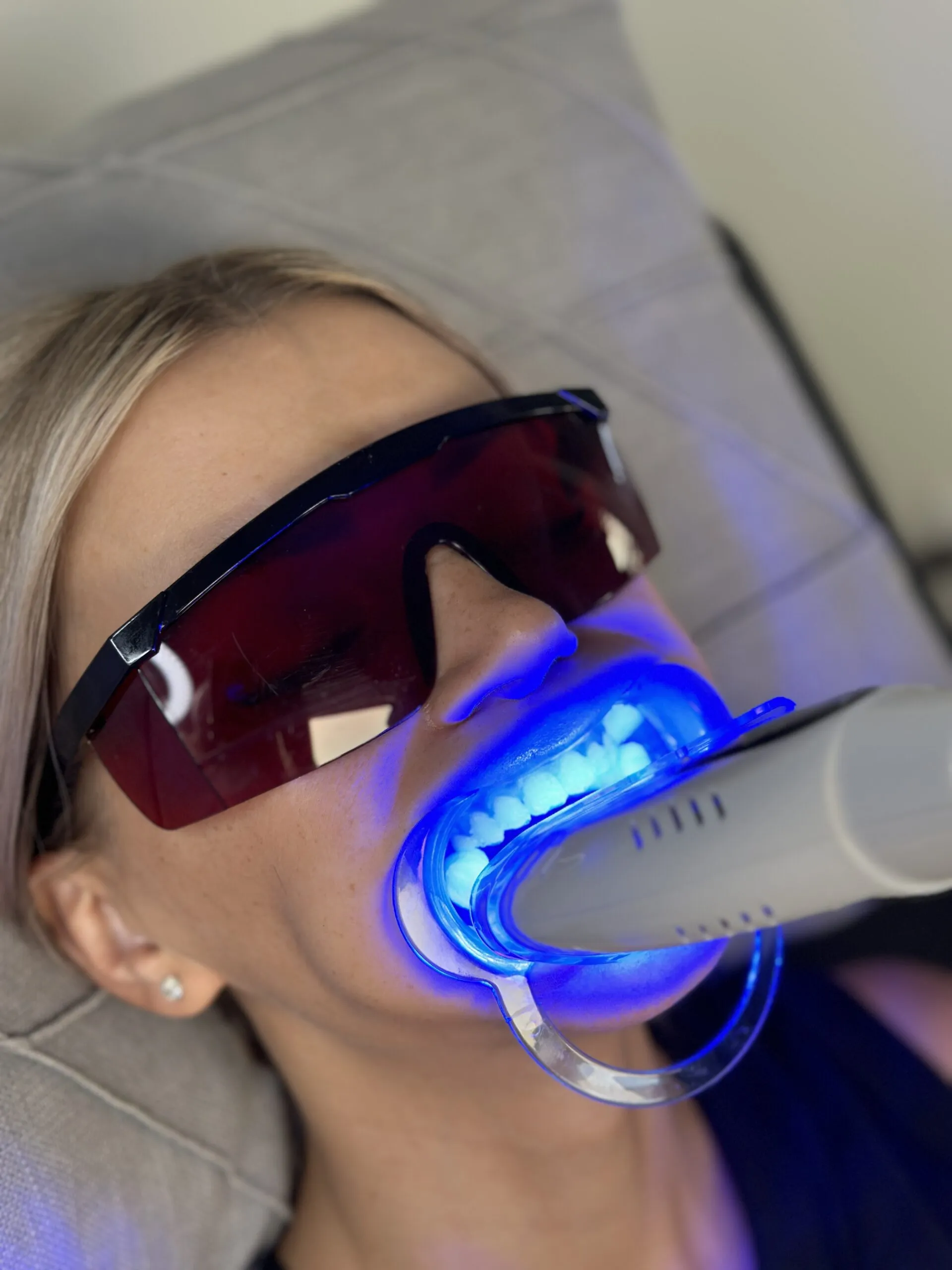 26254 salon teeth whitening image6