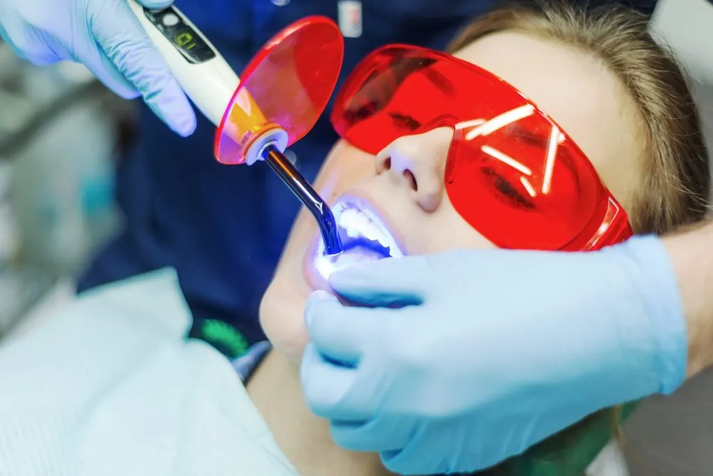 26258 teeth whitening frisco tx image6