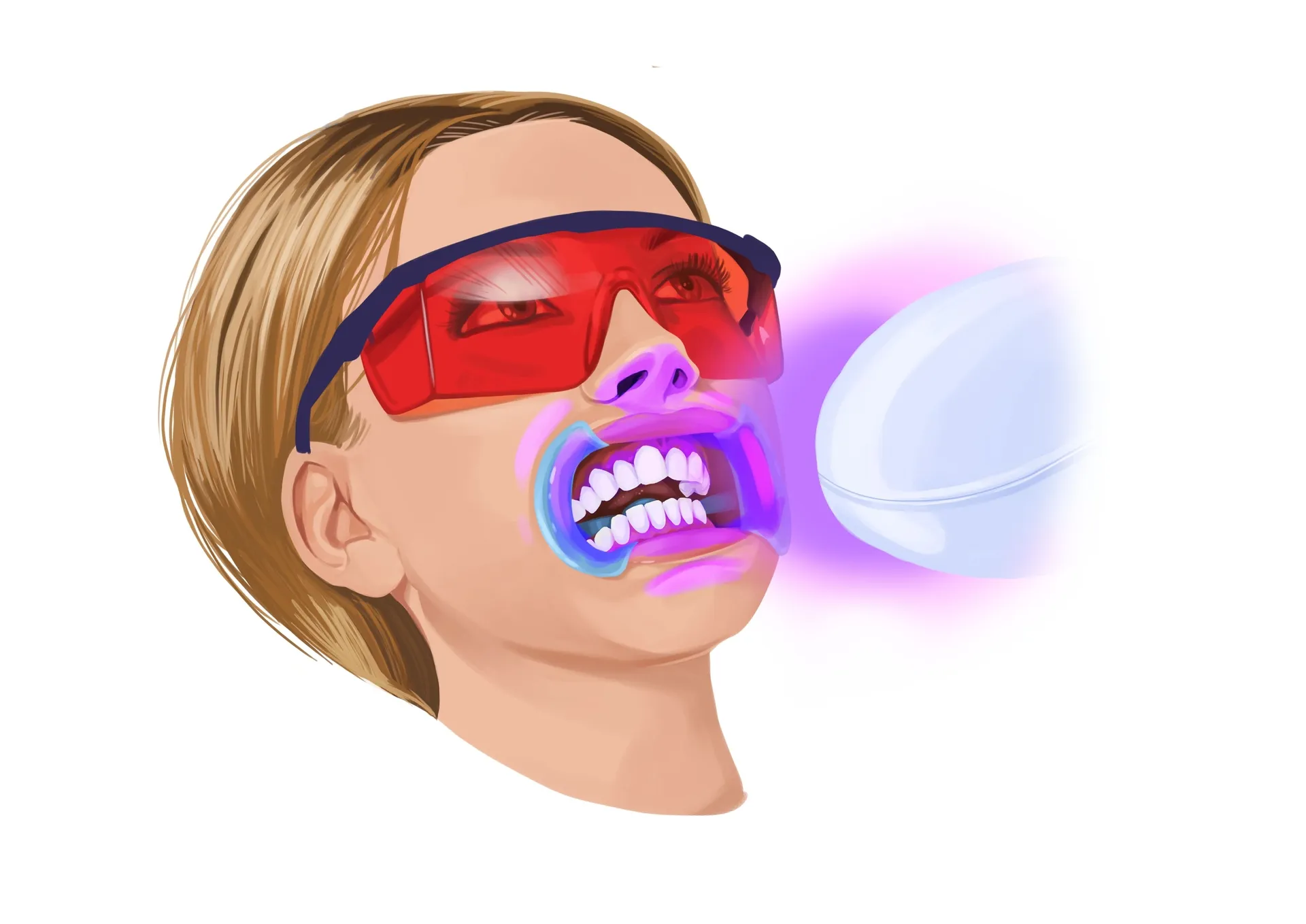 /img/26261-teeth-whitening-aftercare.webp