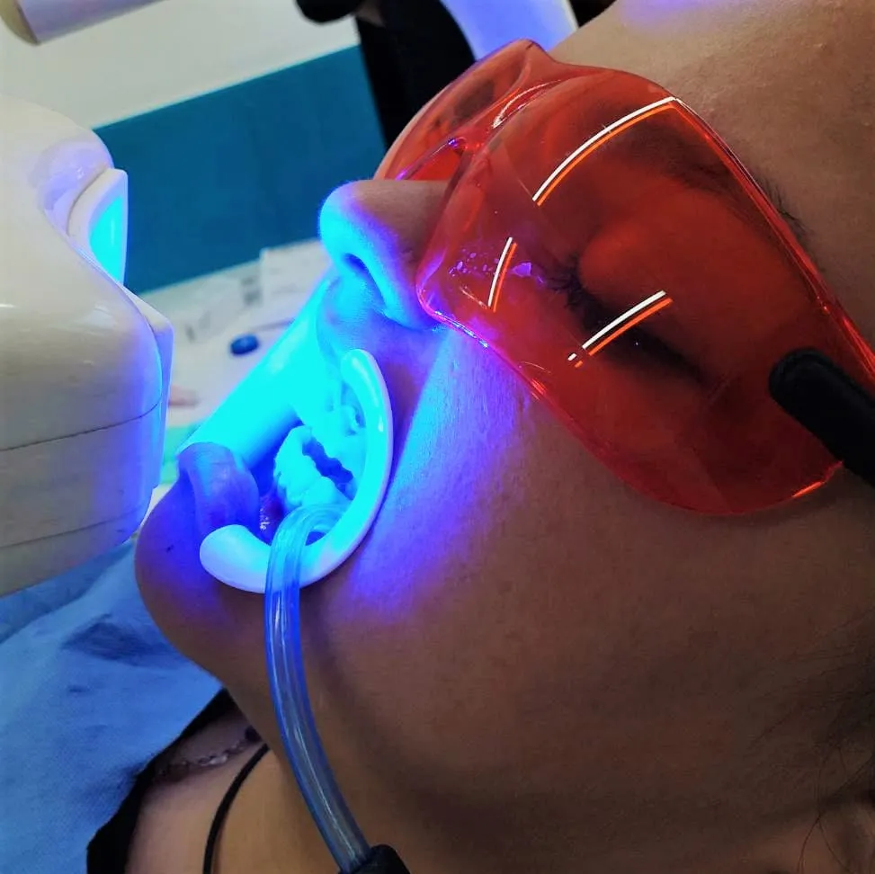 26261 teeth whitening cost comparison