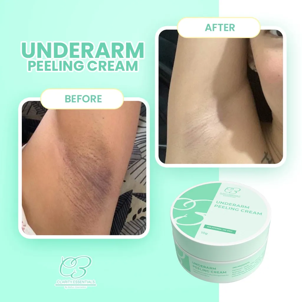 26262 underarm exfoliation