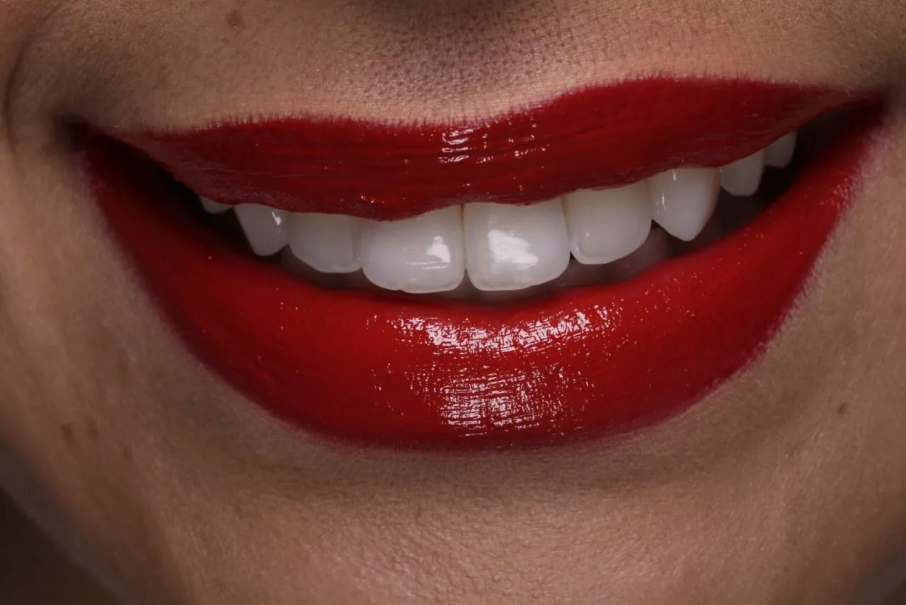 26263 healthy white smile