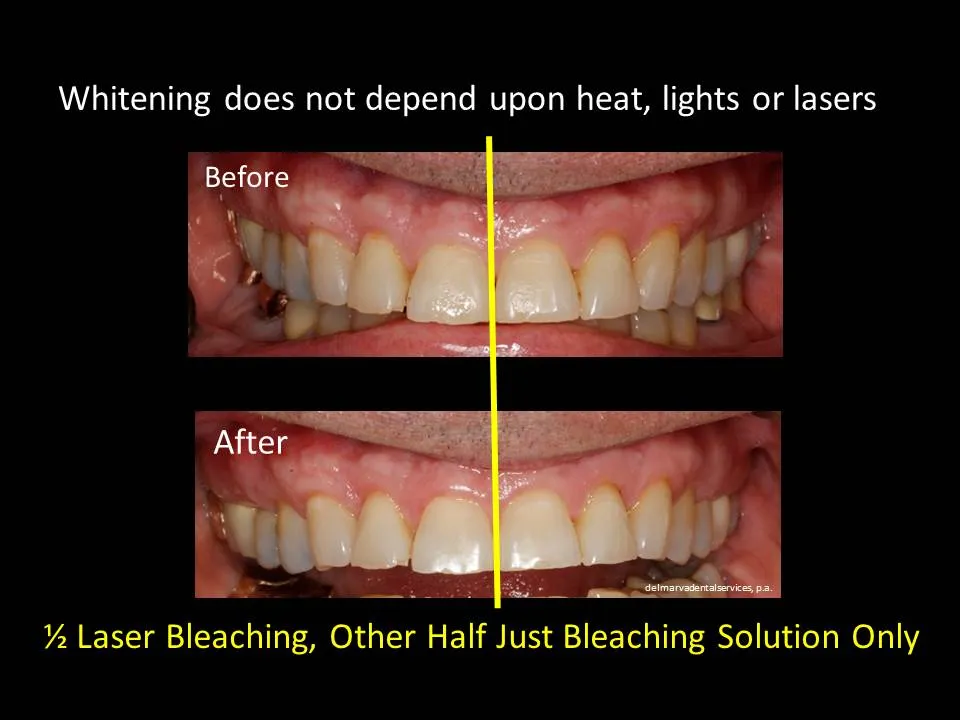 26263 hydrogen peroxide concentration