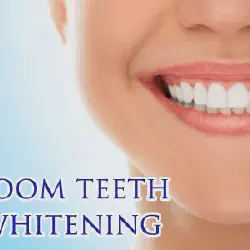 /img/26265-teeth-whitening-aftercare.webp