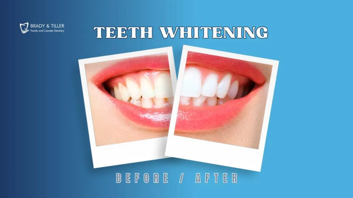 26279 whitening toothpaste
