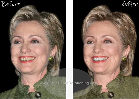 26288 lighting impact on teeth