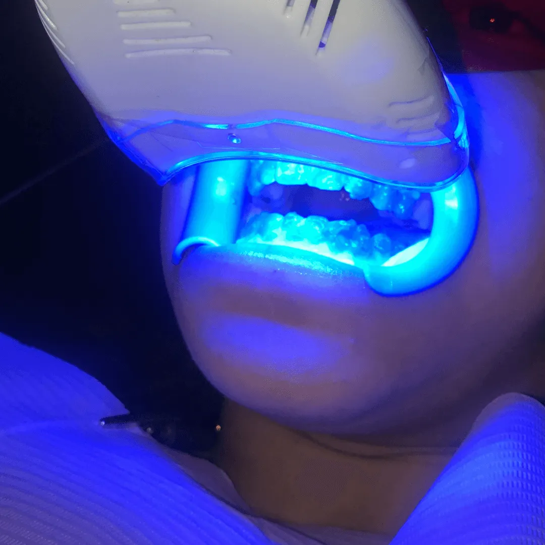 26289 free teeth whitening image3