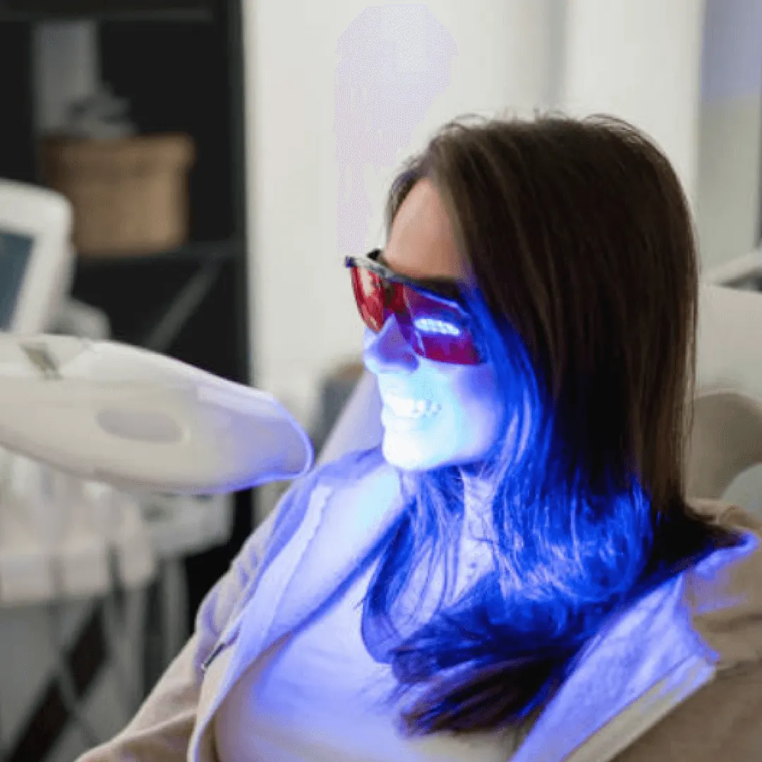 26289 free teeth whitening image5