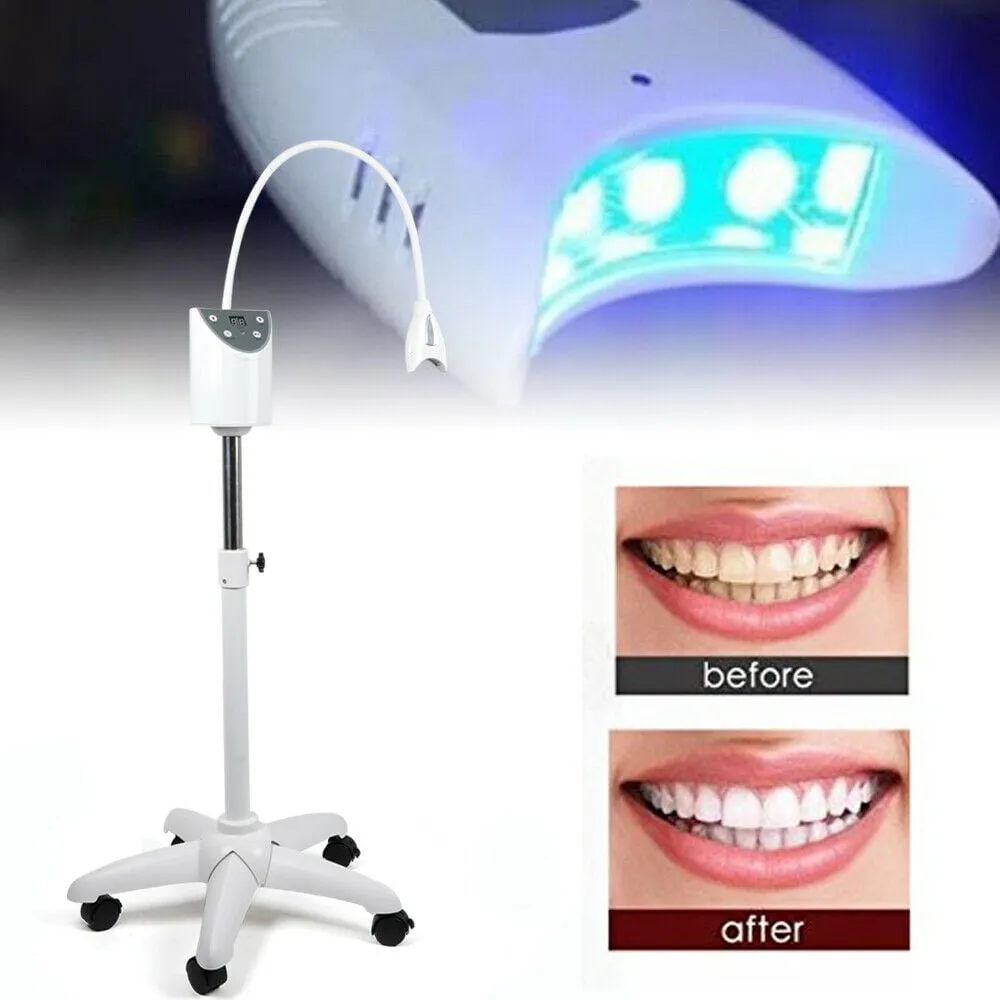 26300 led teeth whitening before after 4