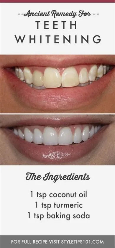 26308 professional dental care