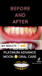 26325 moon whitening pen packaging