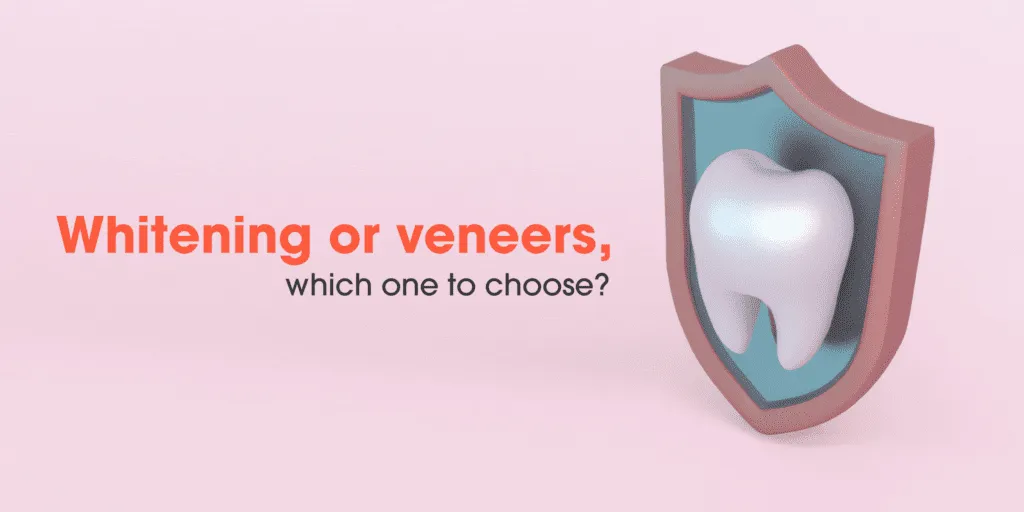 26343 veneers teeth whitening maintenance