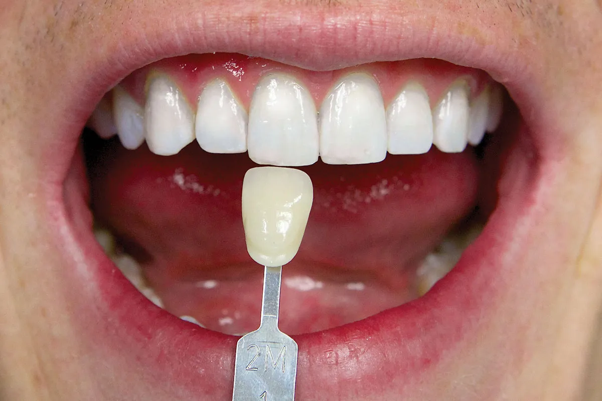 26351 long lasting smile