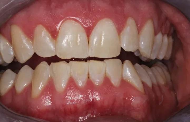 26359 avoid staining foods