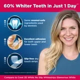 26369 teeth whitening before after