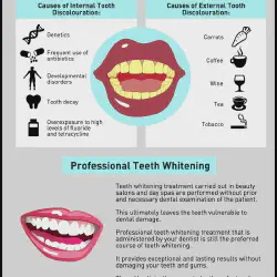 /img/26370-teeth-whitening-results.webp