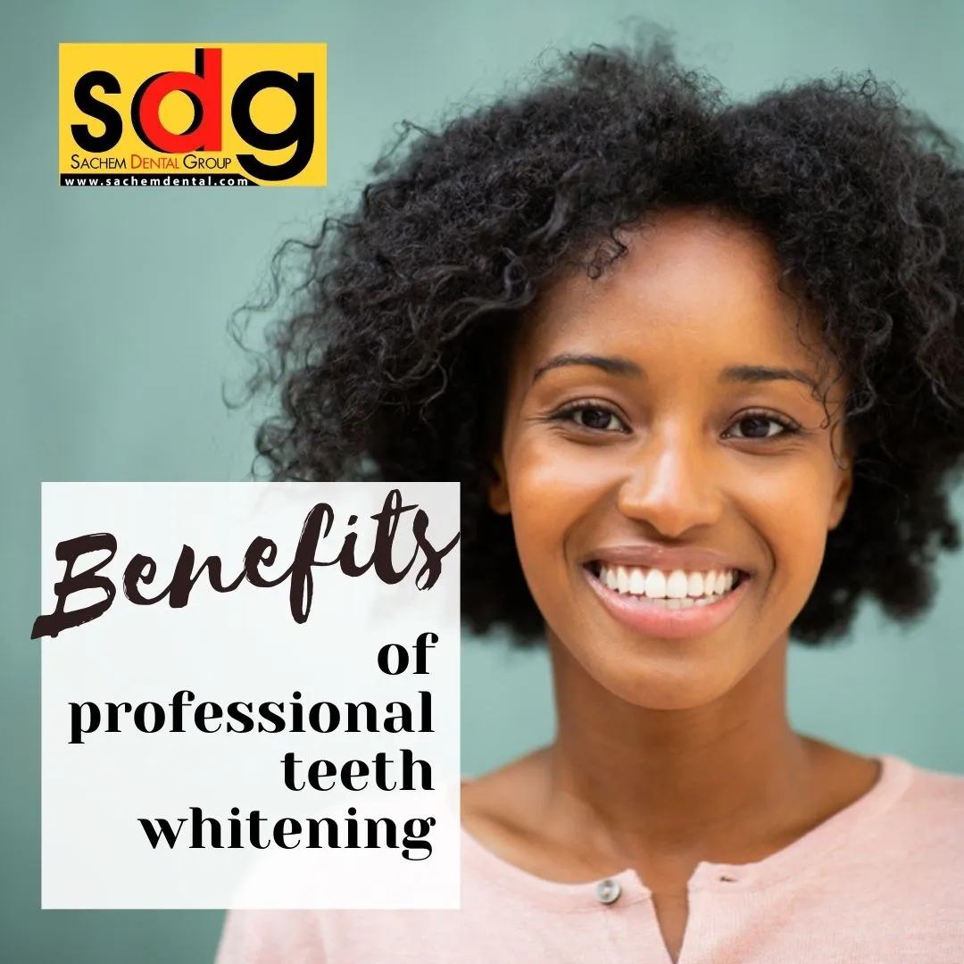 26370 teeth whitening sensitivity