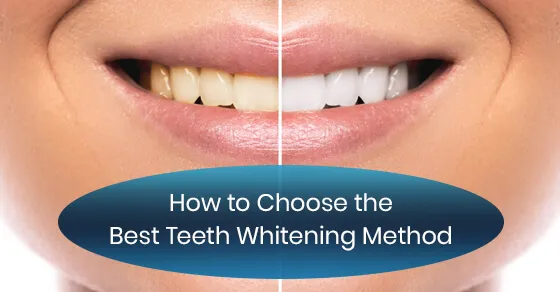 26372 whitening strips