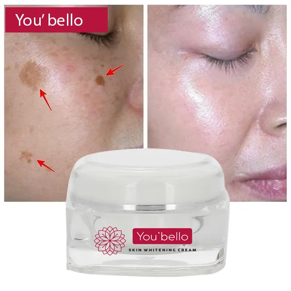 26373 dark spots skin