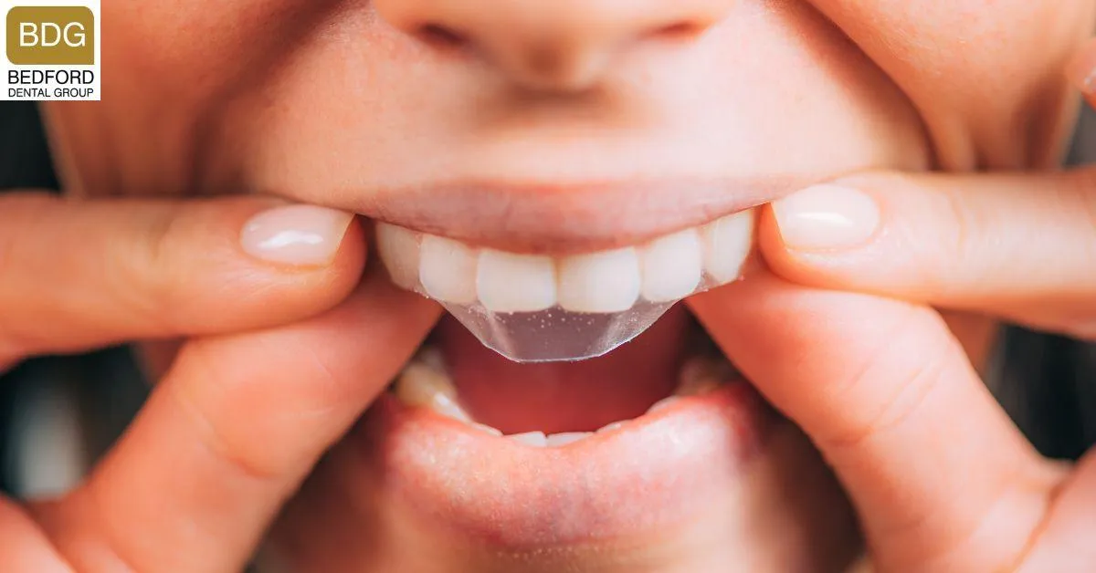 26385 zoom whitening patient