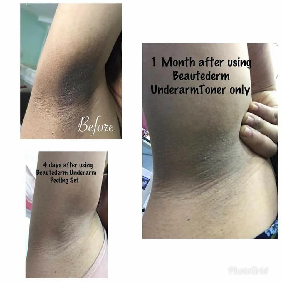 26407 dermatologist consultation