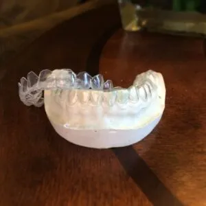 26410 whitening process clayton