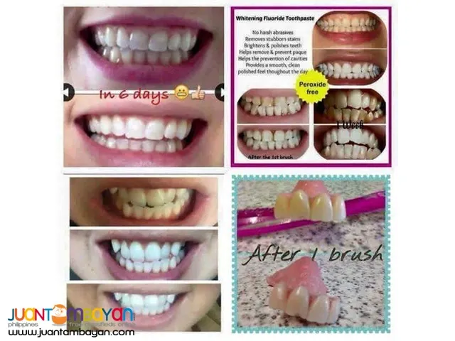 26429 teeth whitening strips