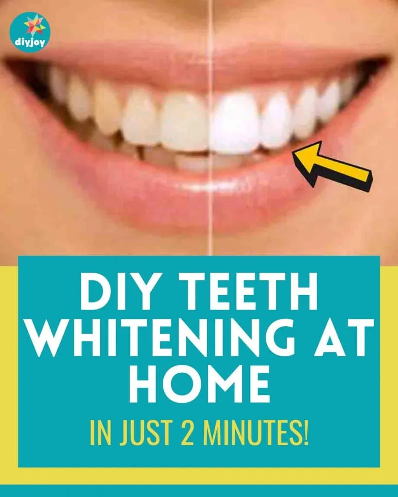 26449 baking soda teeth whitening