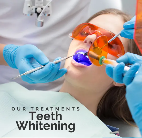 26450 teeth whitening bay plaza procedure