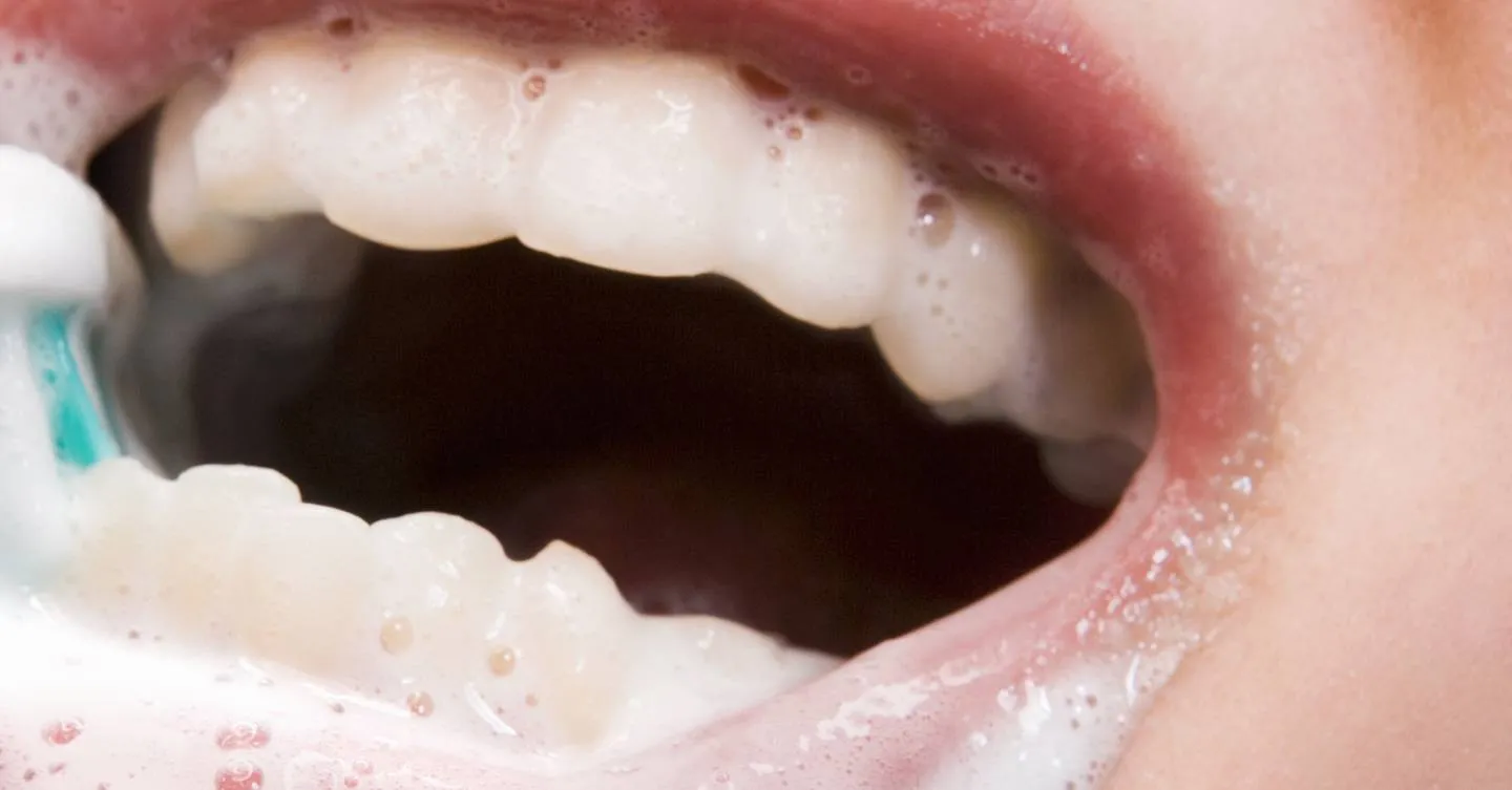 26453 hydrogen peroxide teeth