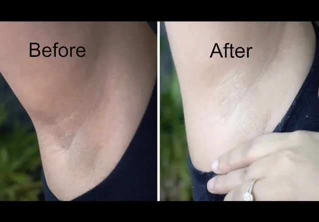 26458 underarm moisturizing tips