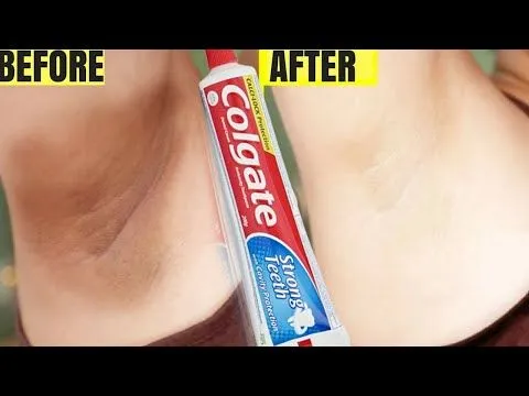 26458 underarm whitening challenge