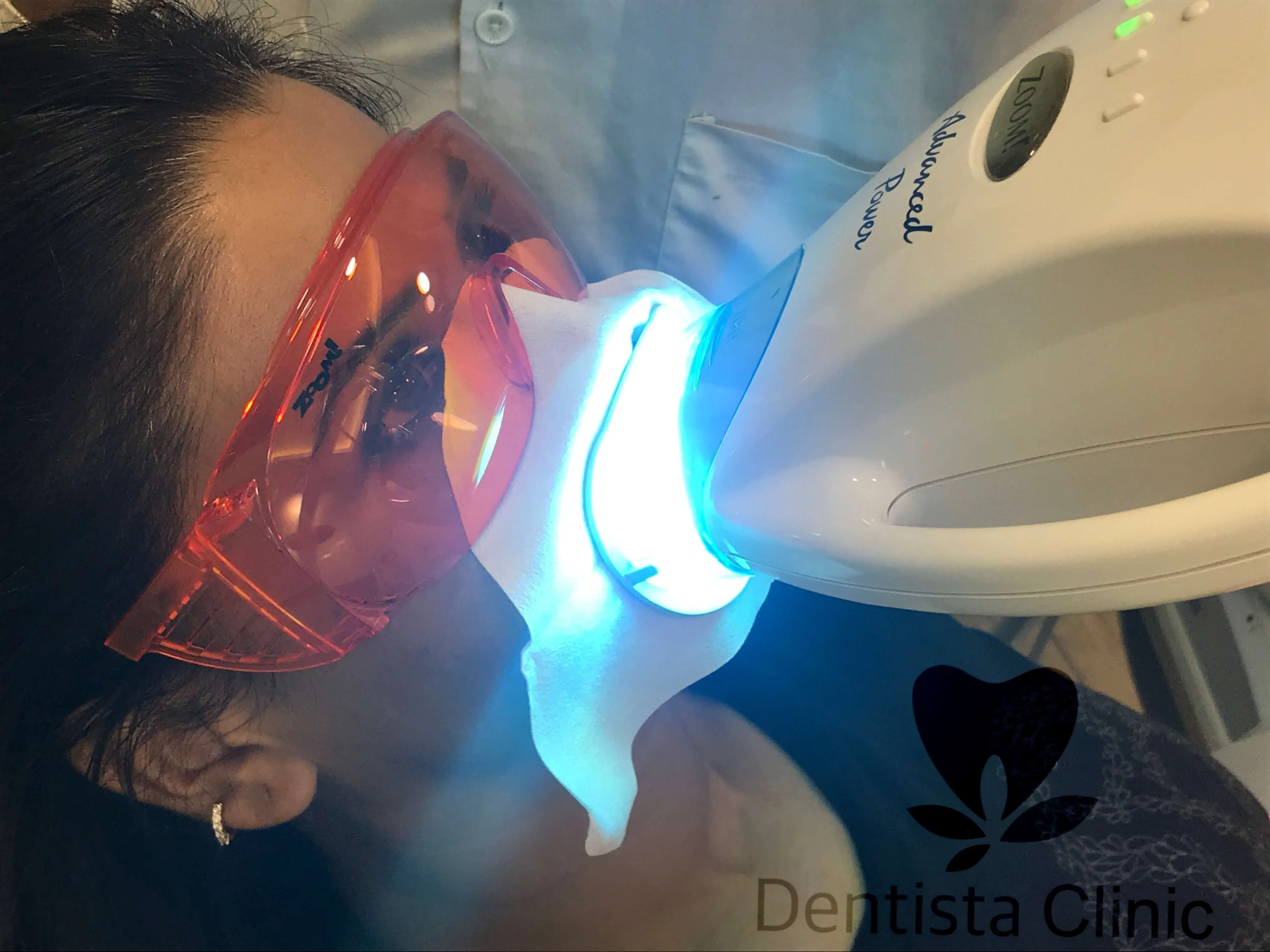 26463 chic delta teeth whitening diet