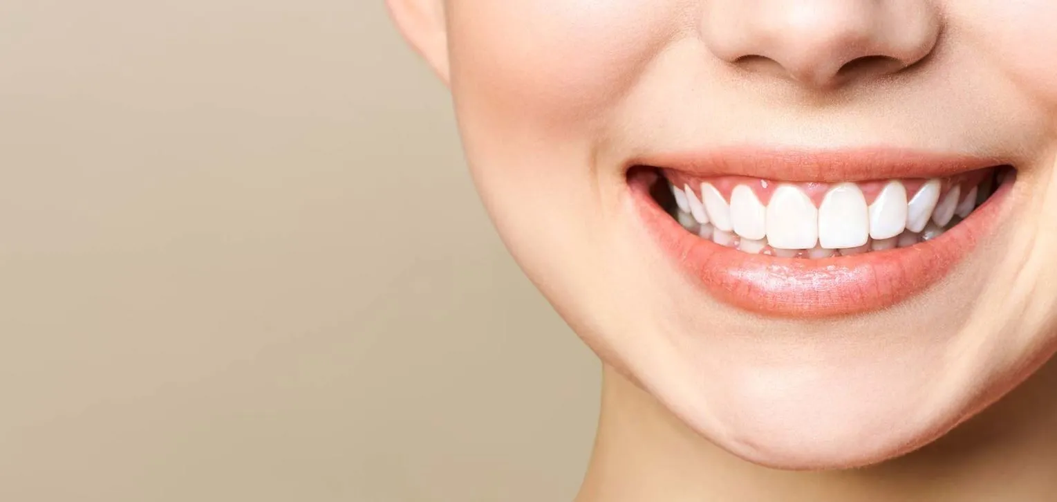 26476 at home teeth whitening kit