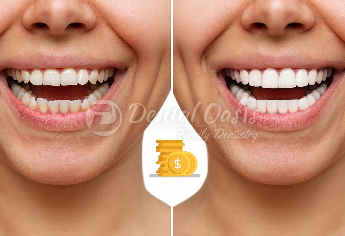 26479 teeth whitening pretoria dentist