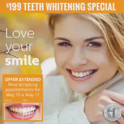 /img/26482-teeth-whitening-frisco-tx-smile.webp