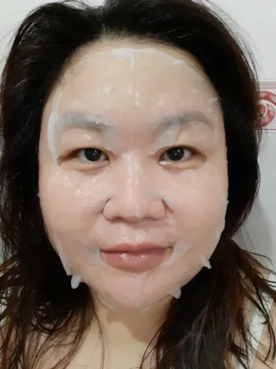 26483 vitamin c skin benefits